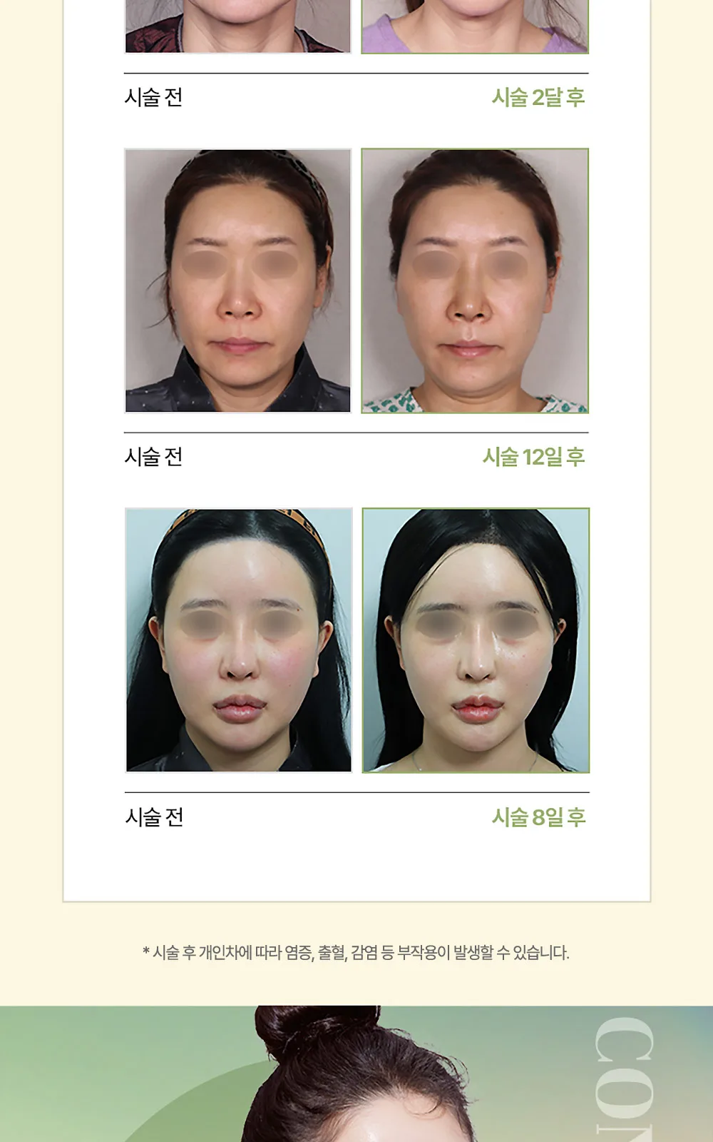 시술 상세 12