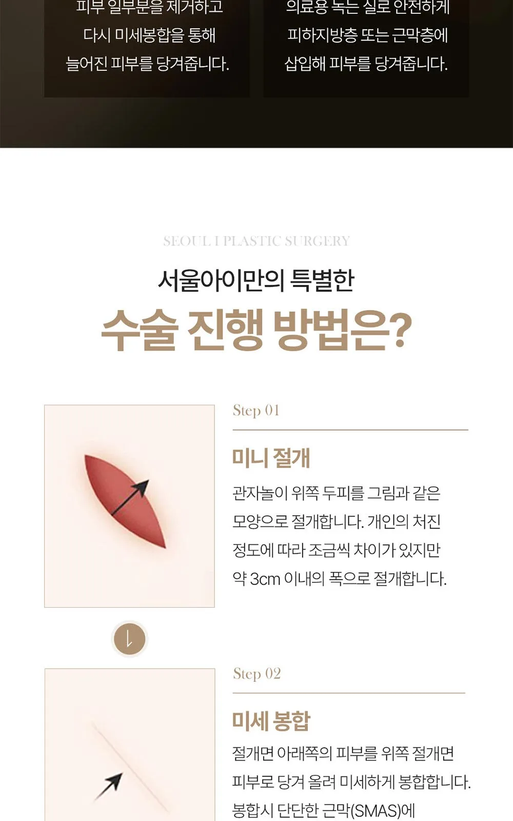 시술 상세 5