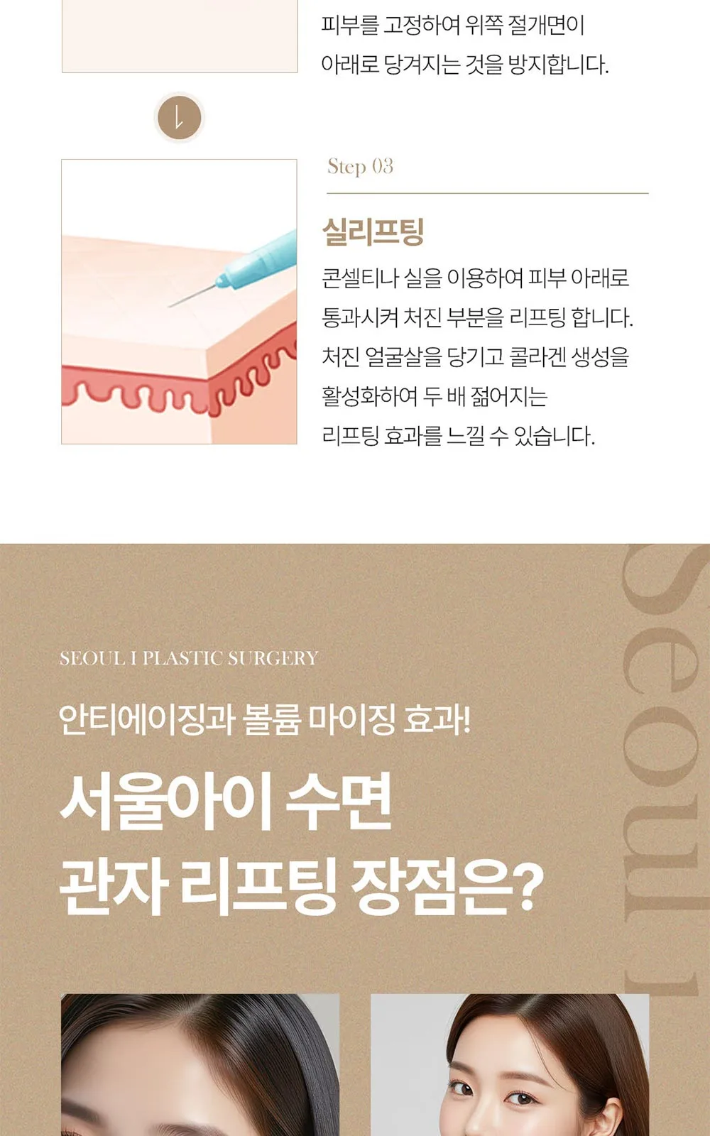 시술 상세 6