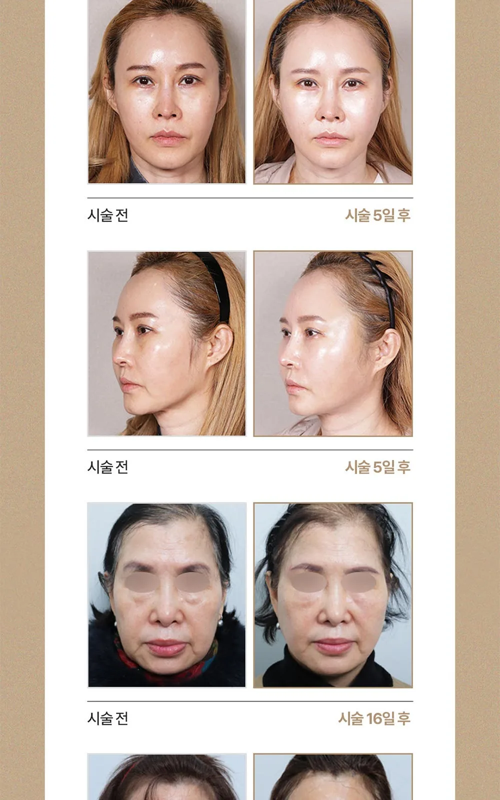 시술 상세 12