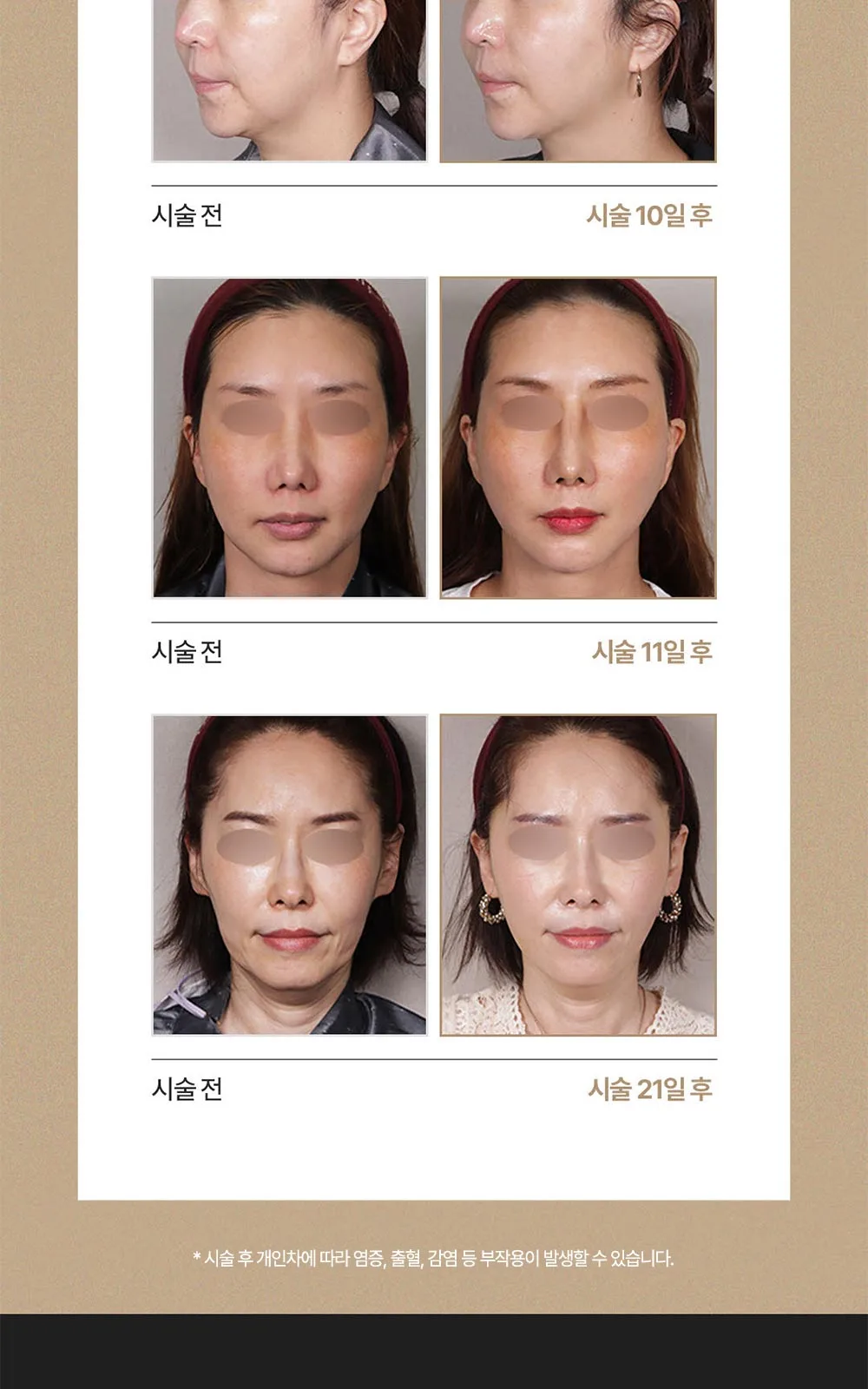 시술 상세 14