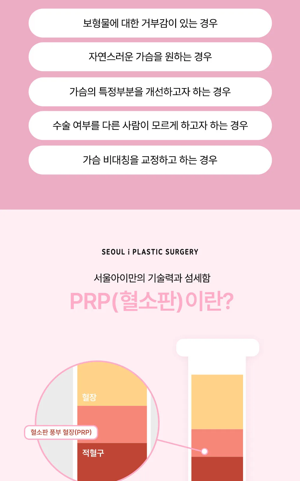 시술 상세 3