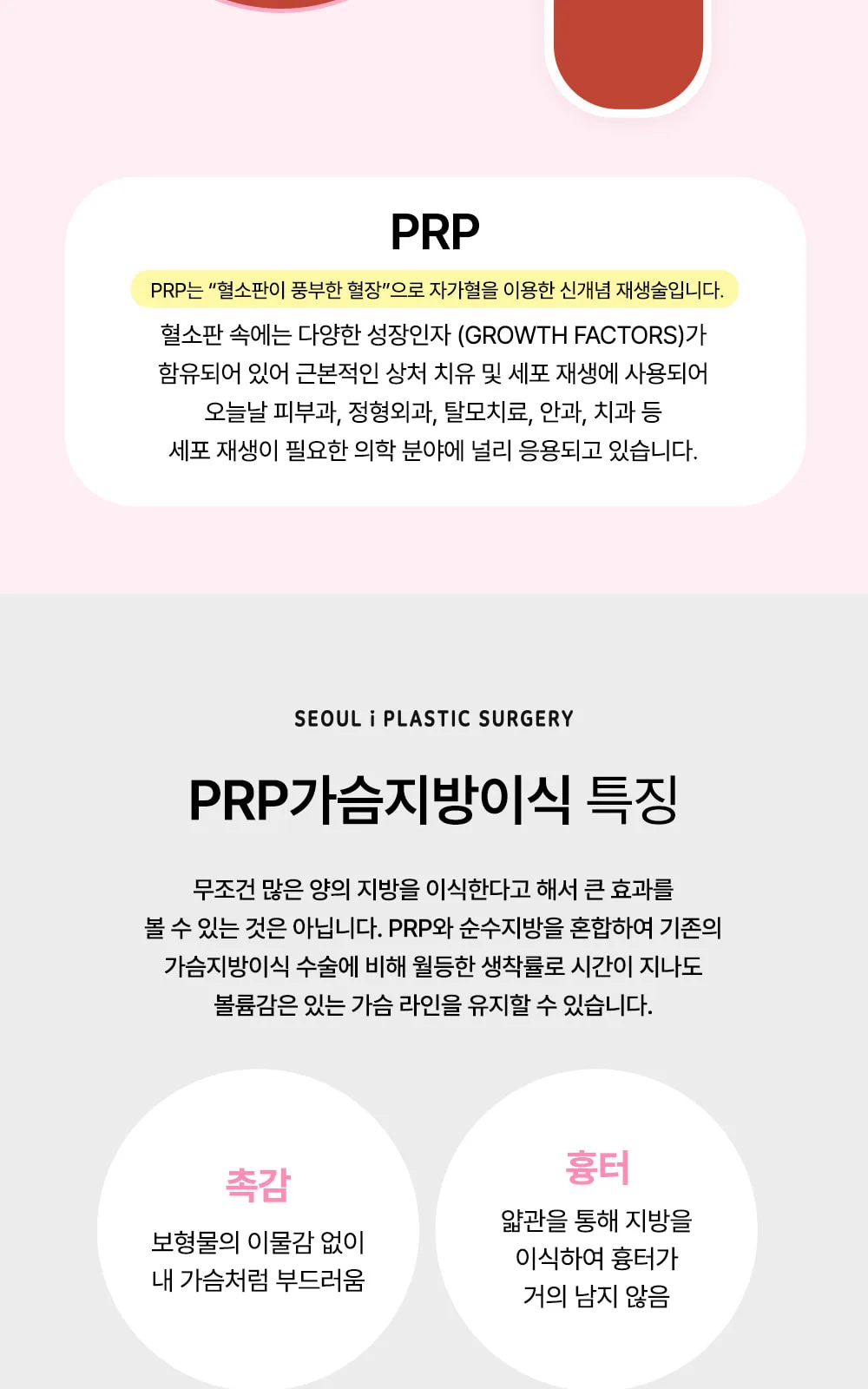 시술 상세 4