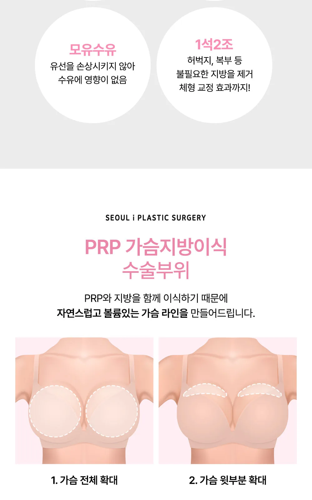 시술 상세 5