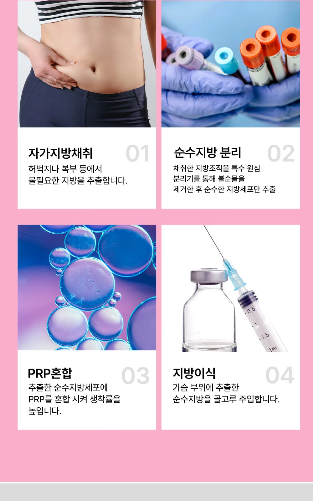 시술 상세 7