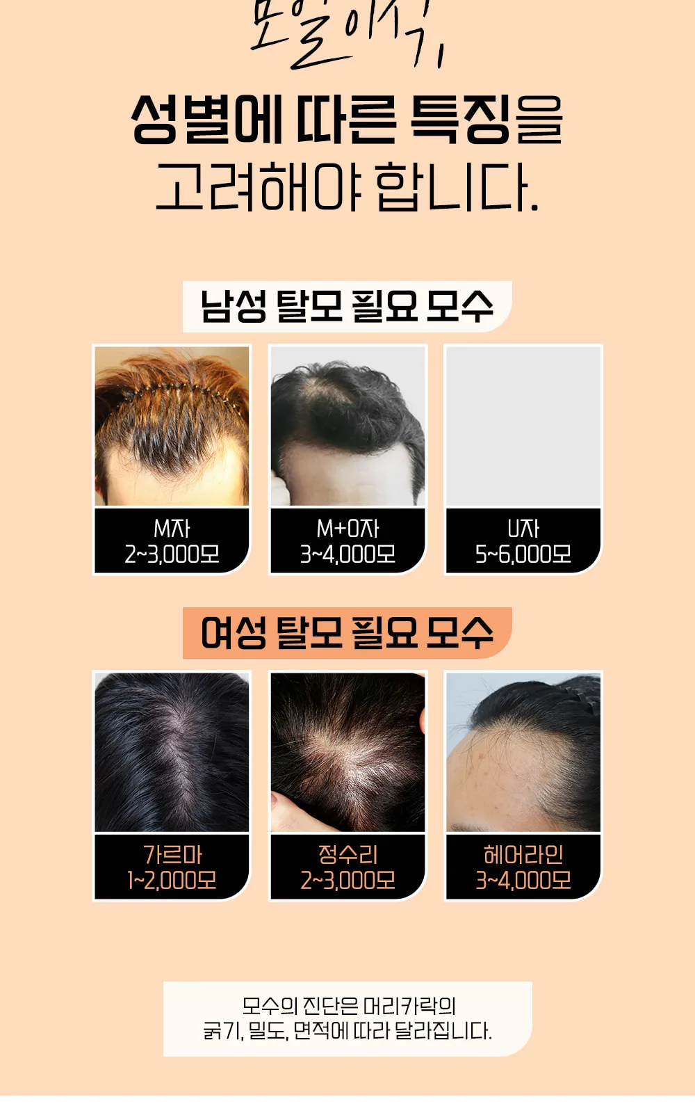 시술 상세 3