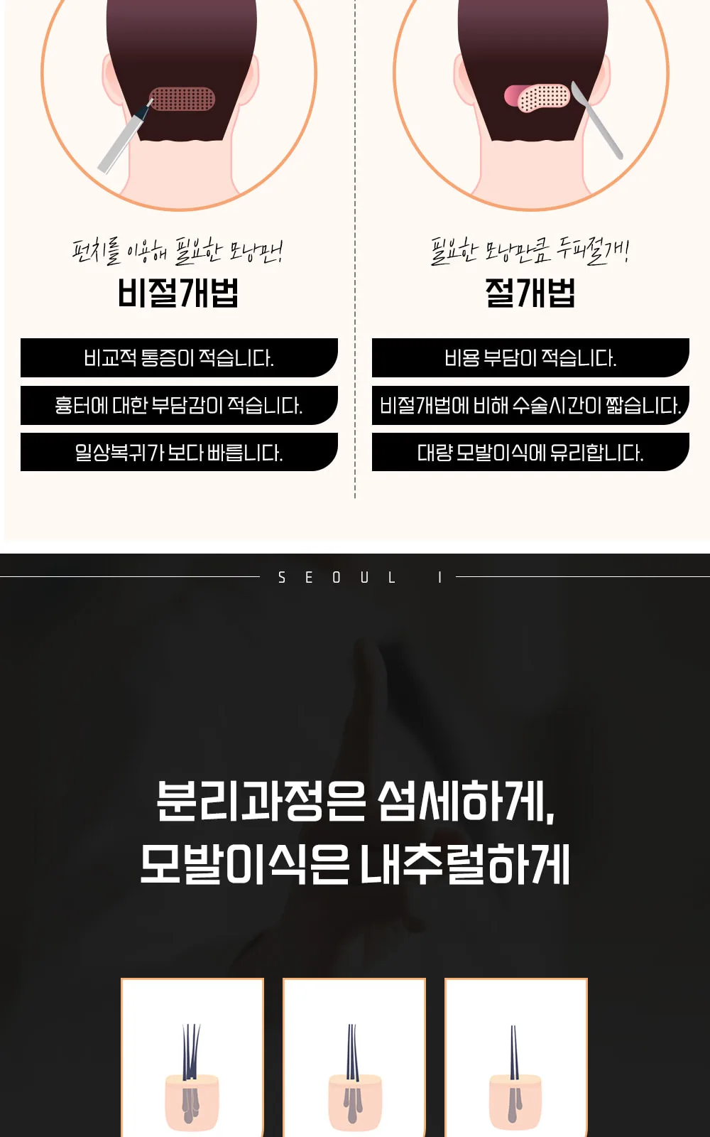 시술 상세 5