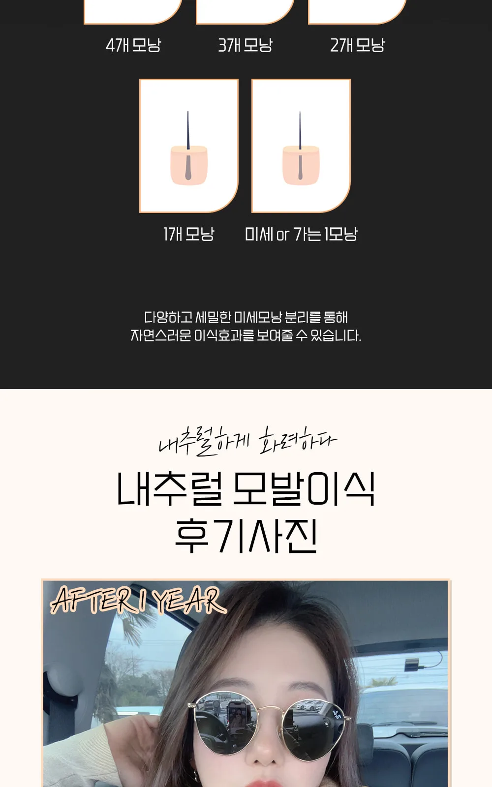시술 상세 6