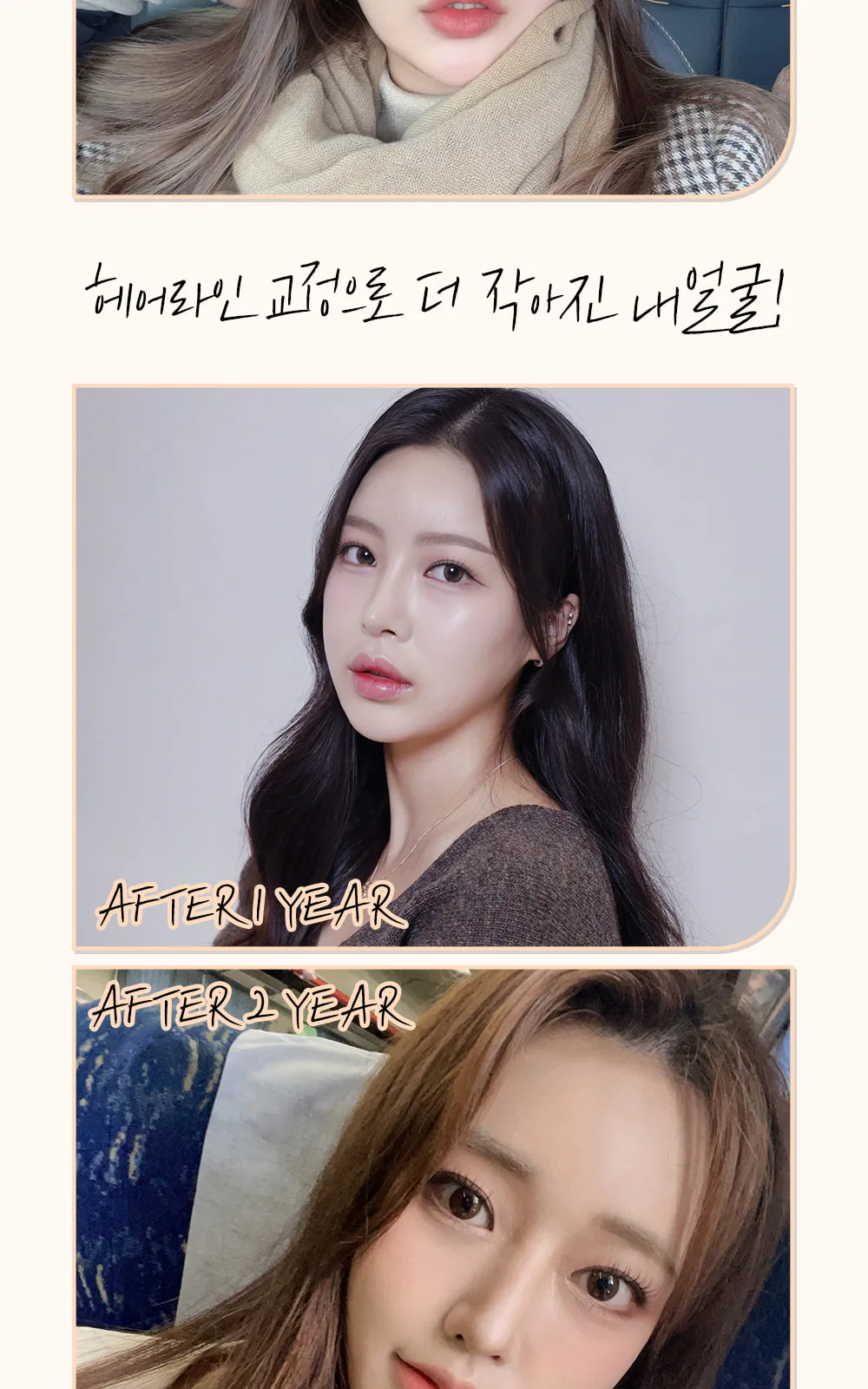 시술 상세 7