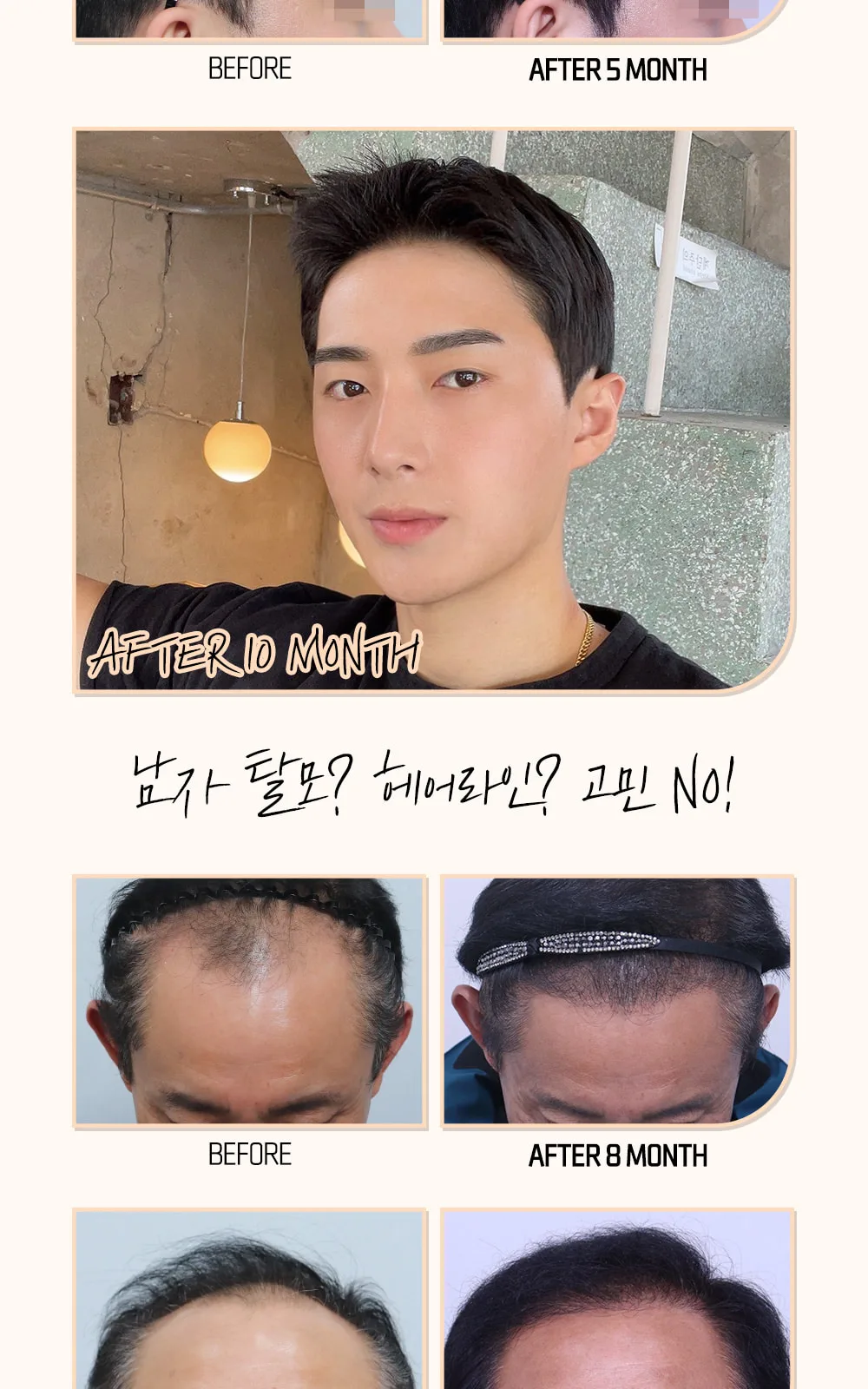 시술 상세 9