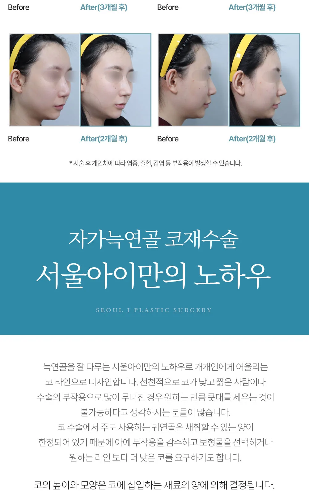 시술 상세 15