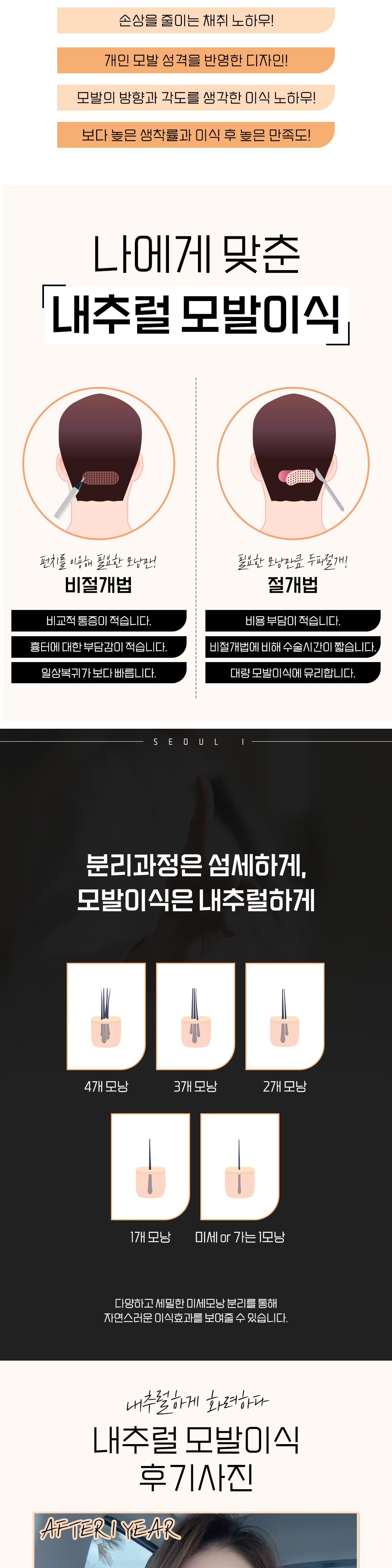시술 상세 2
