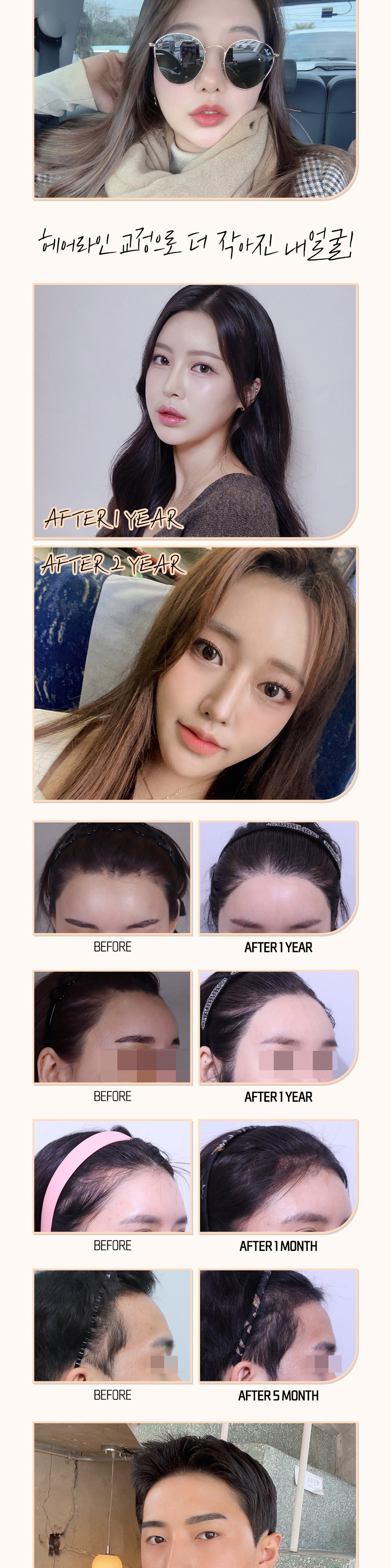 시술 상세 3