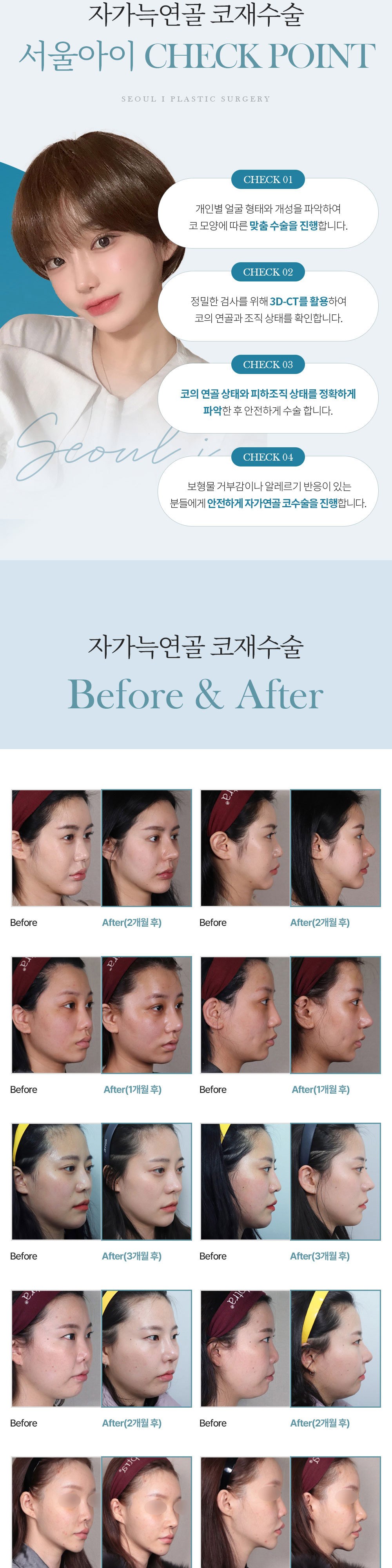 시술 상세 5