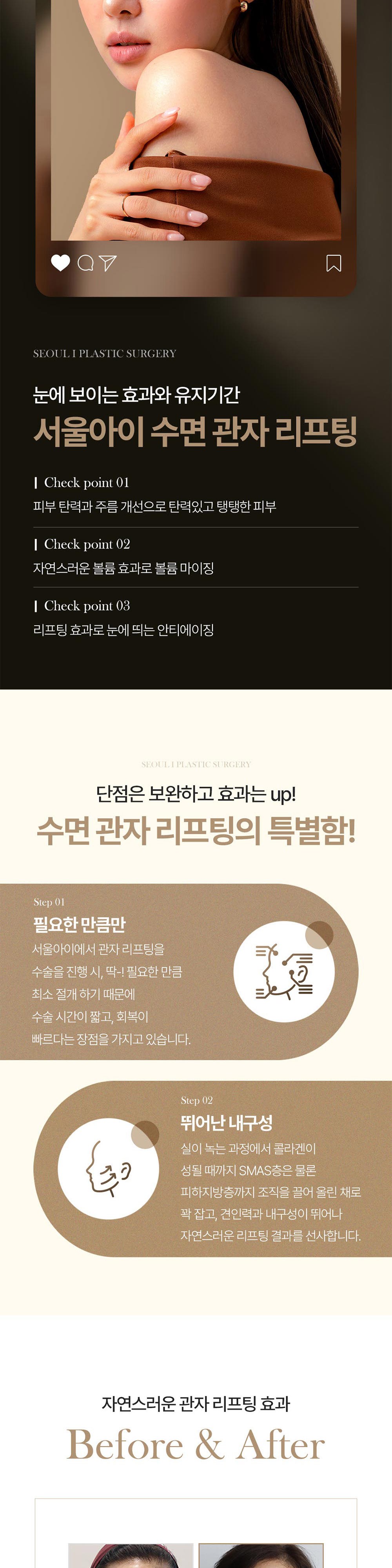 시술 상세 4