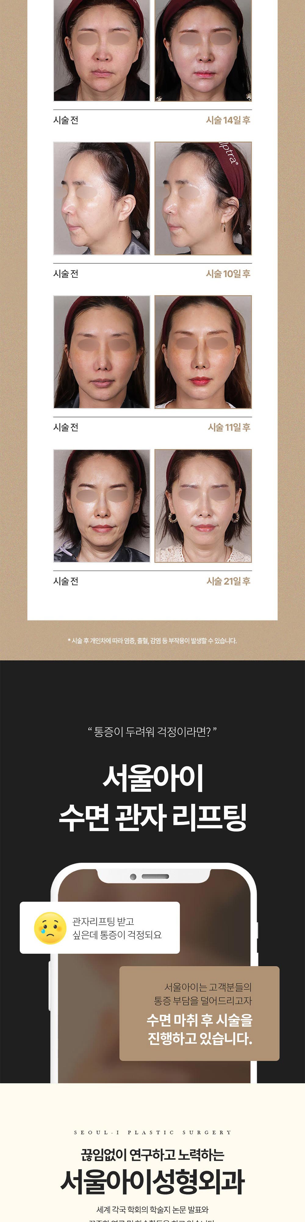 시술 상세 6