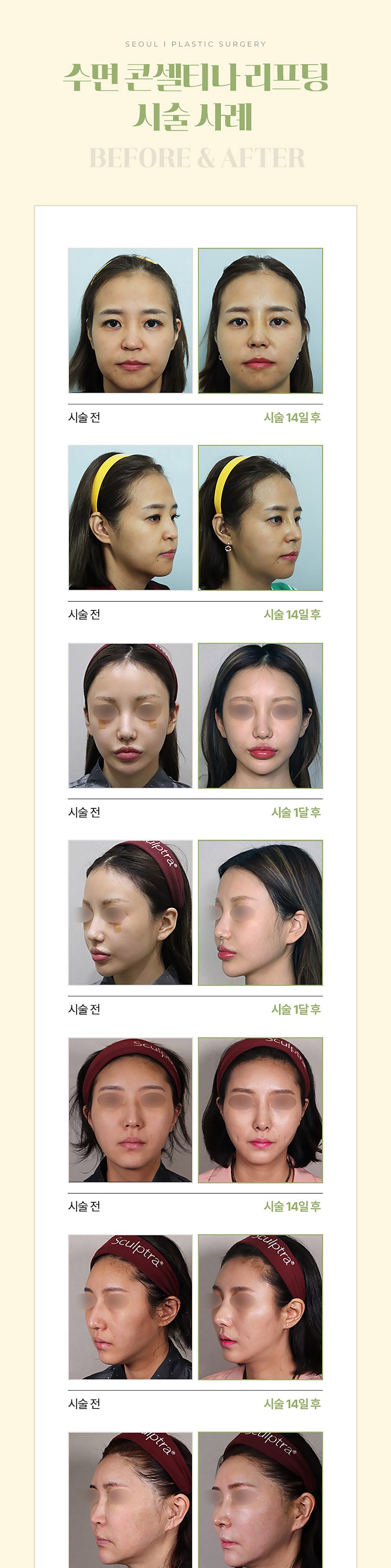 시술 상세 4
