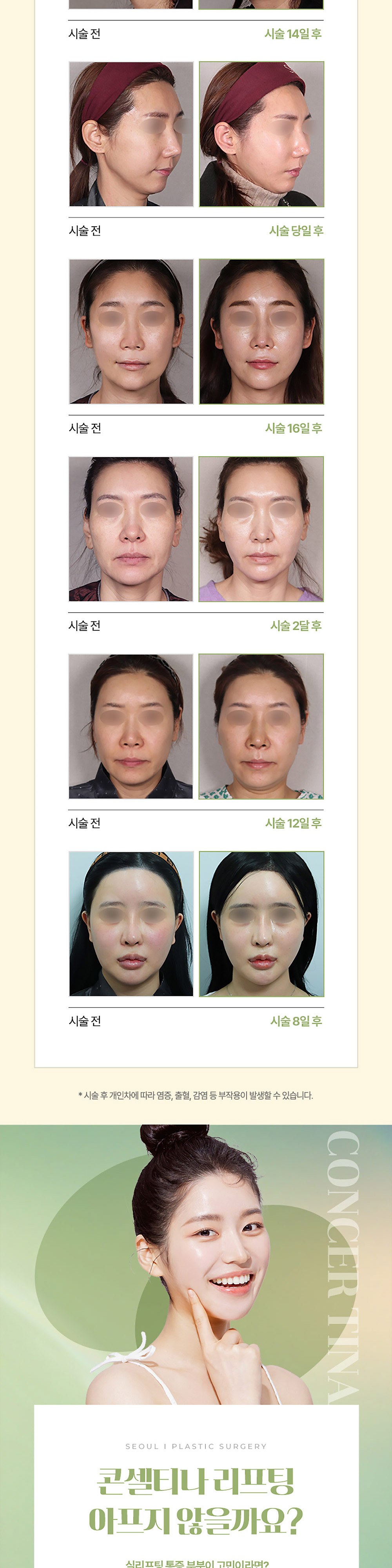 시술 상세 5