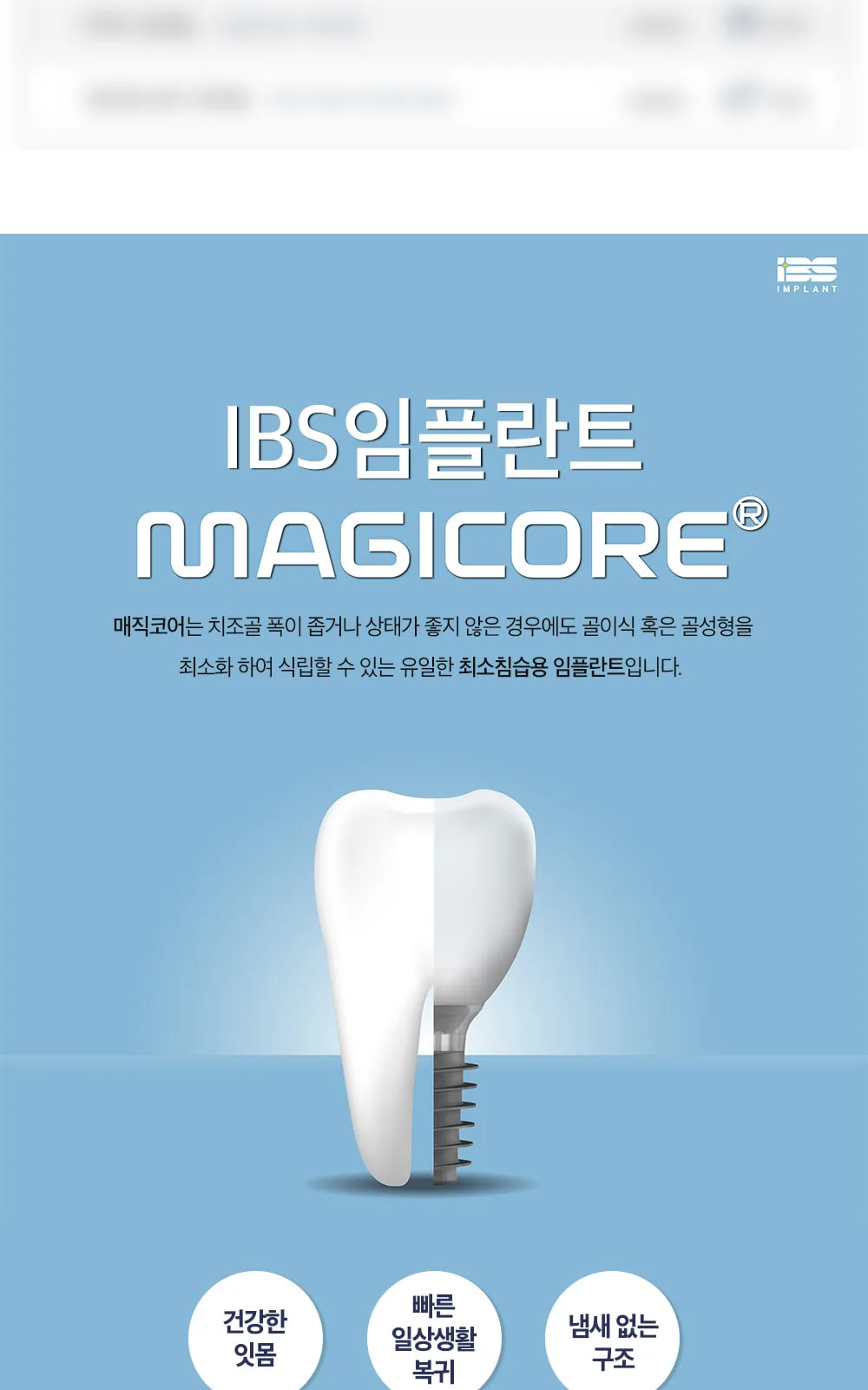 시술 상세 4