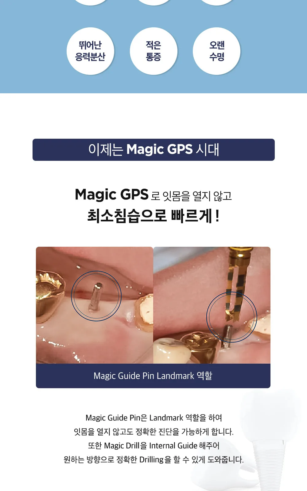 시술 상세 5