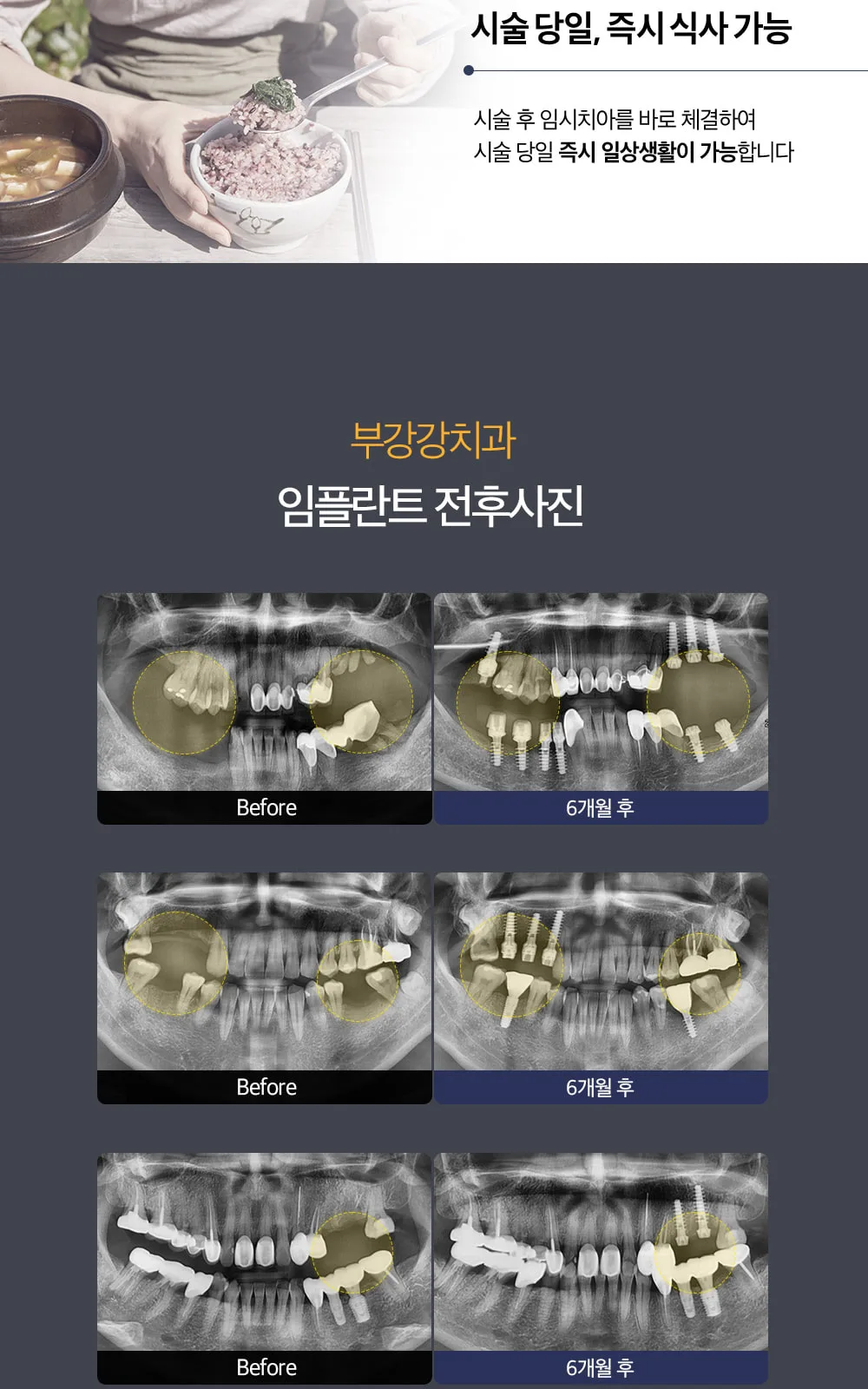시술 상세 8