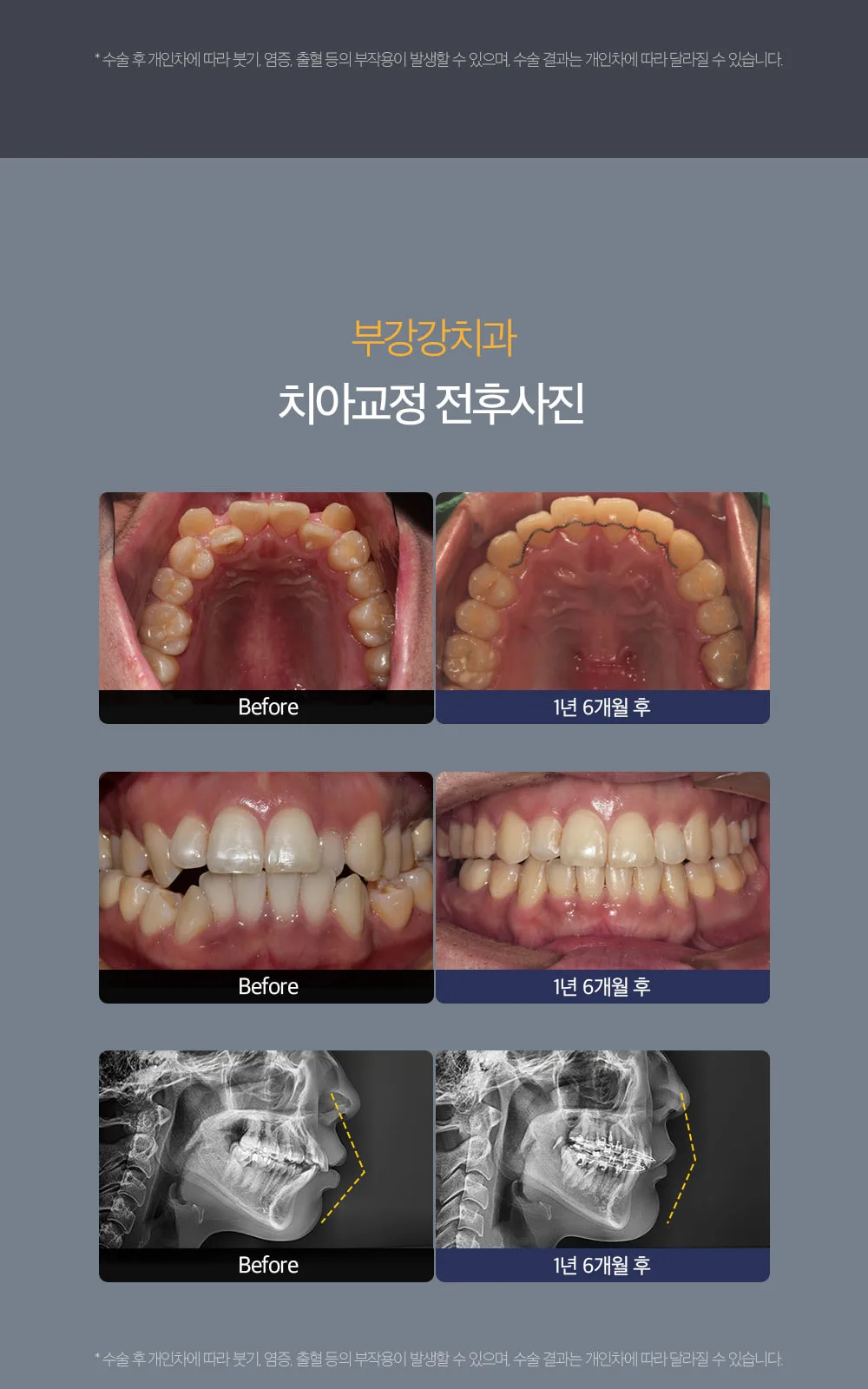 시술 상세 9
