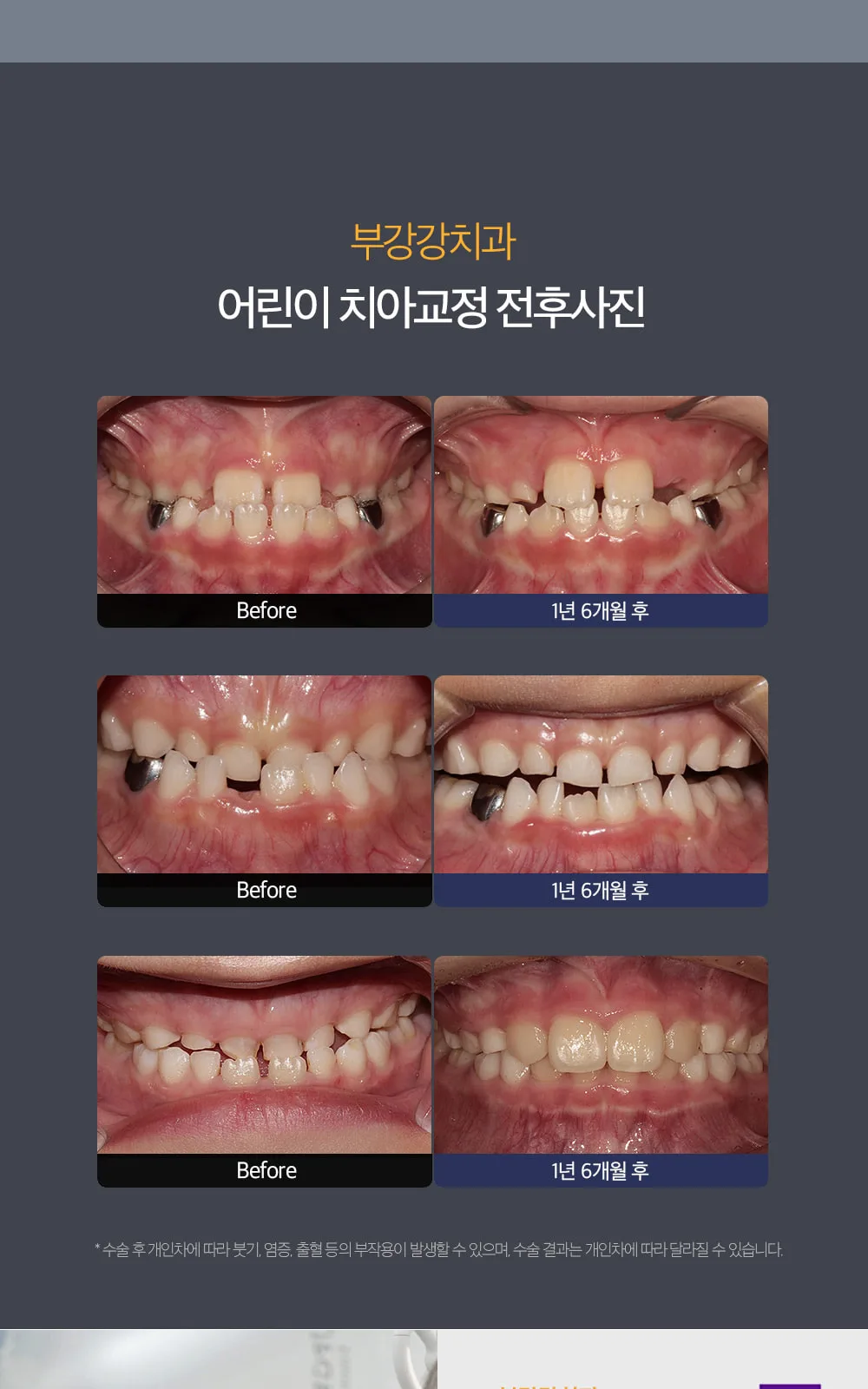 시술 상세 10