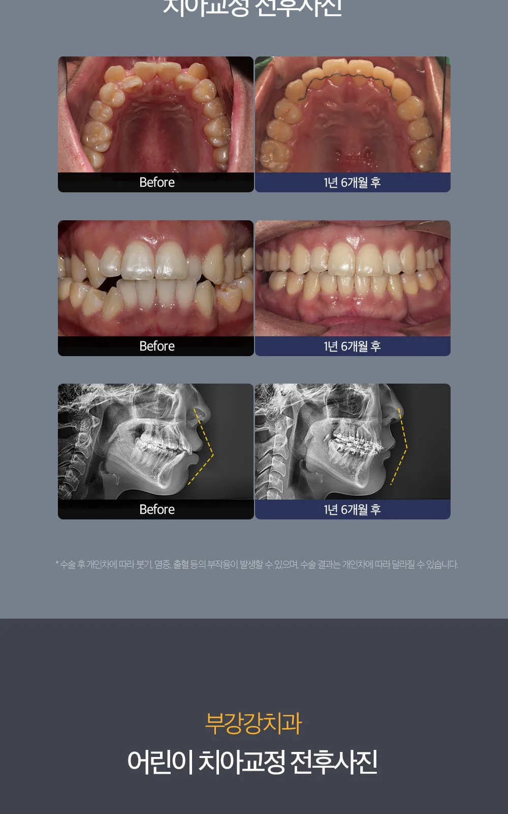시술 상세 3