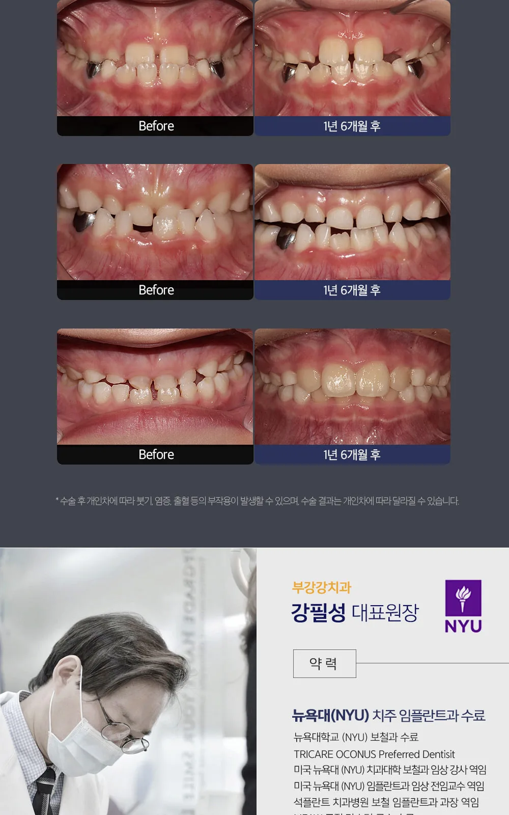 시술 상세 4