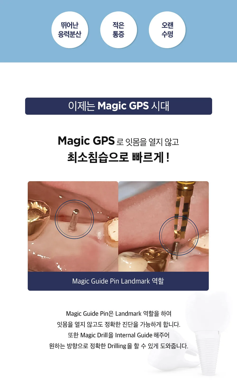 시술 상세 4