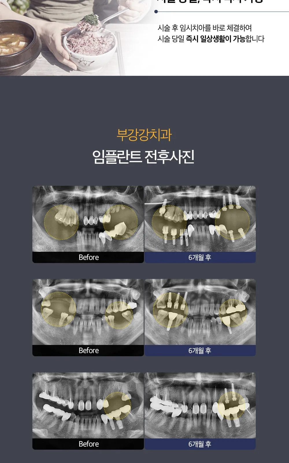 시술 상세 7