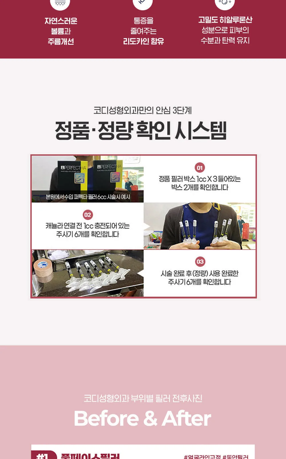 시술 상세 5