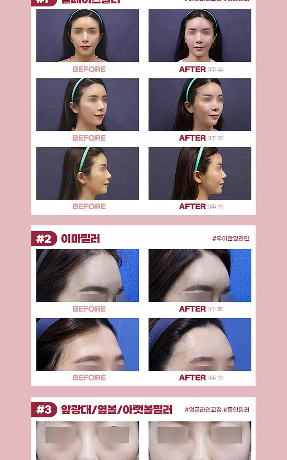 시술 상세 6