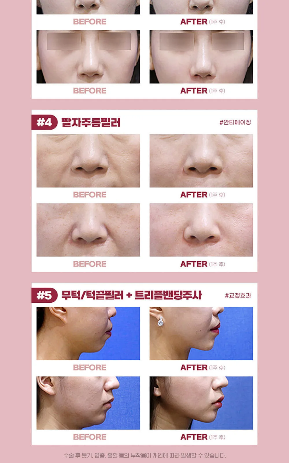 시술 상세 7
