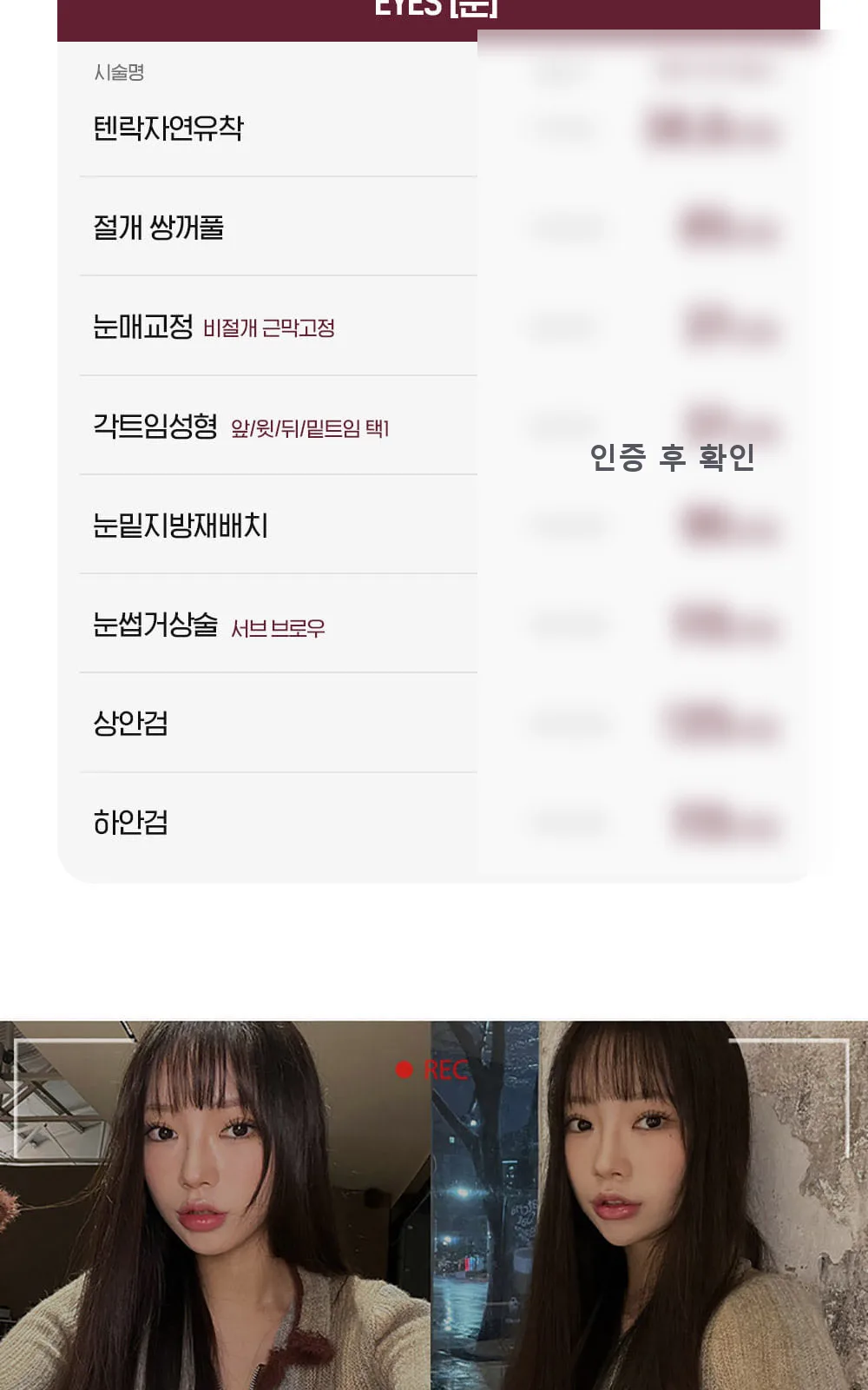 시술 상세 3