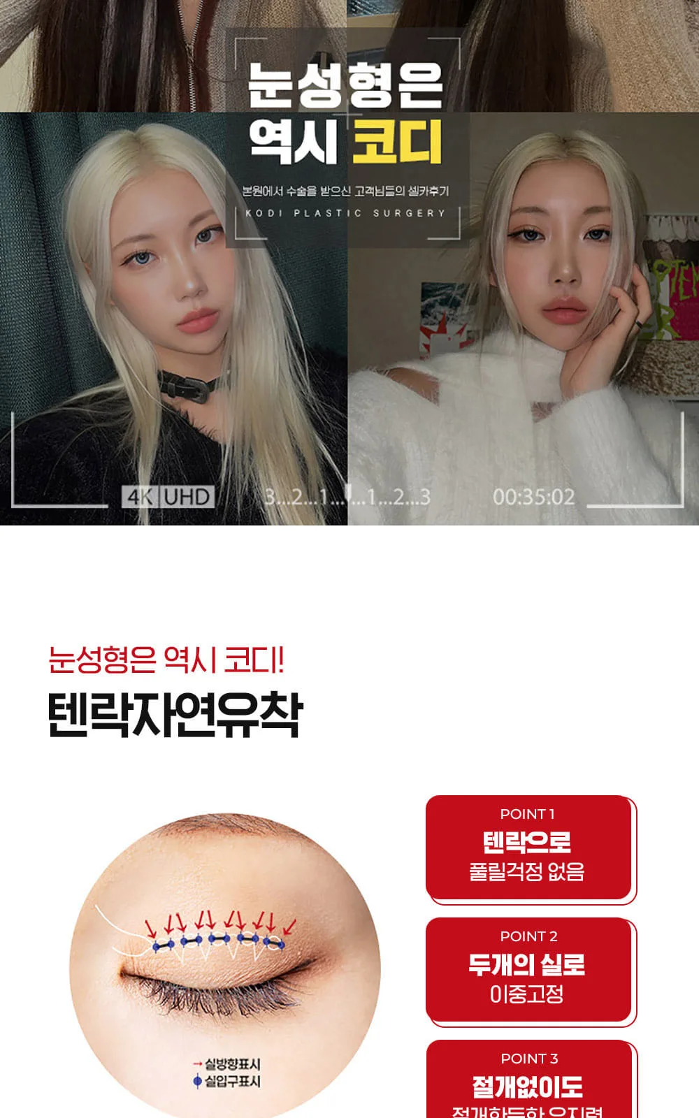 시술 상세 4