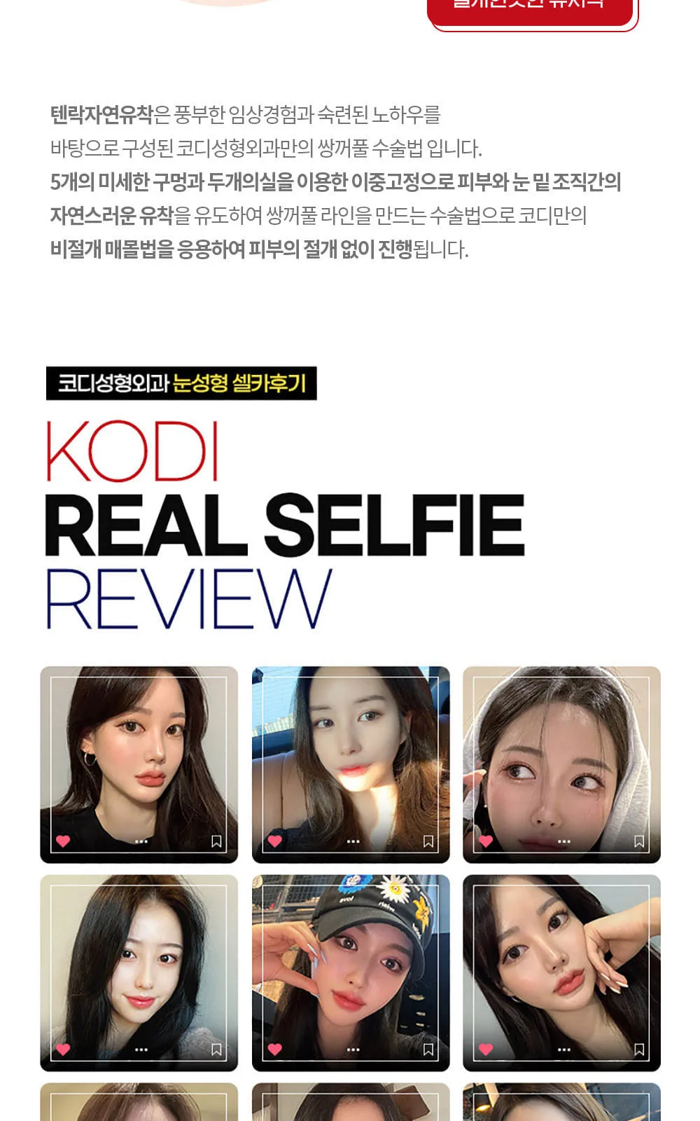 시술 상세 5