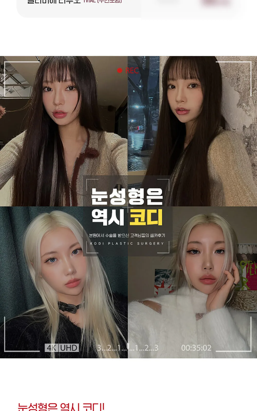 시술 상세 6
