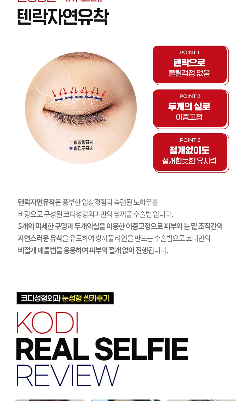 시술 상세 7