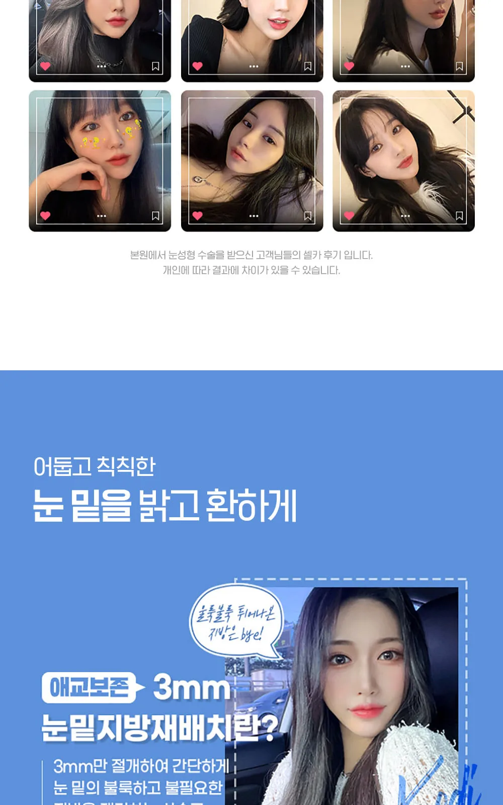 시술 상세 9