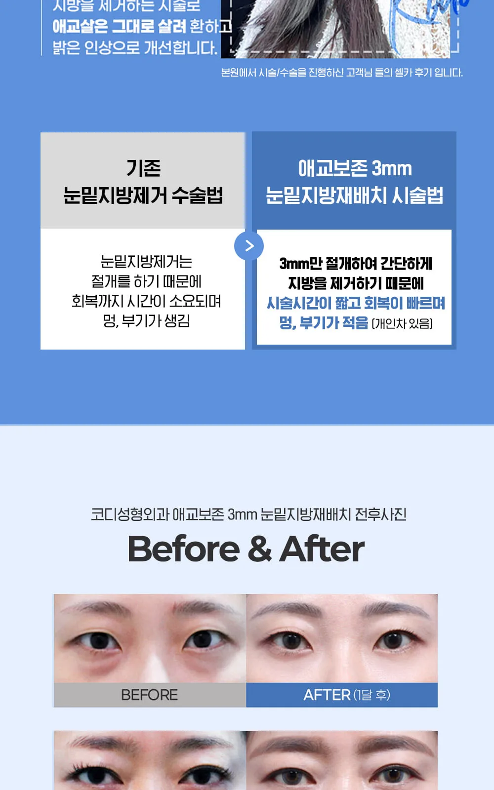 시술 상세 10