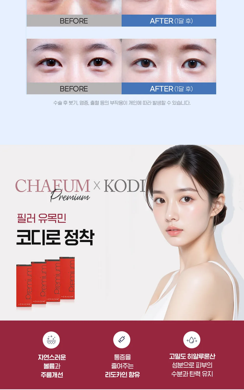 시술 상세 11