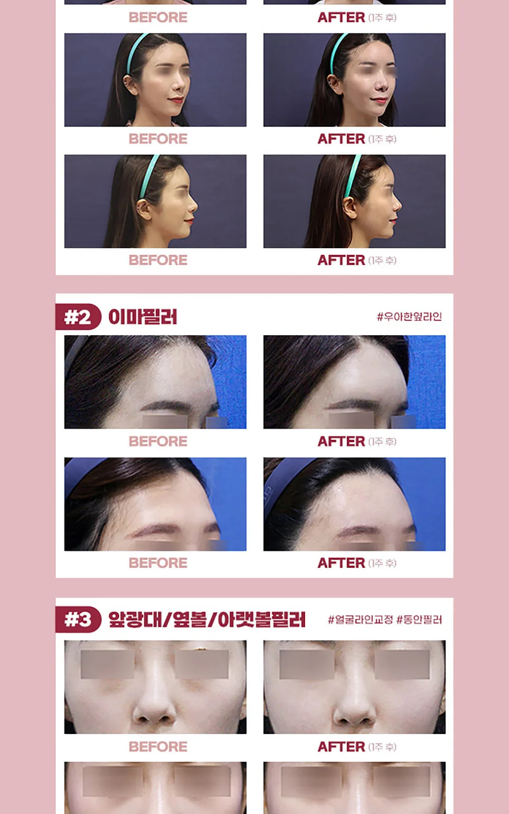 시술 상세 13