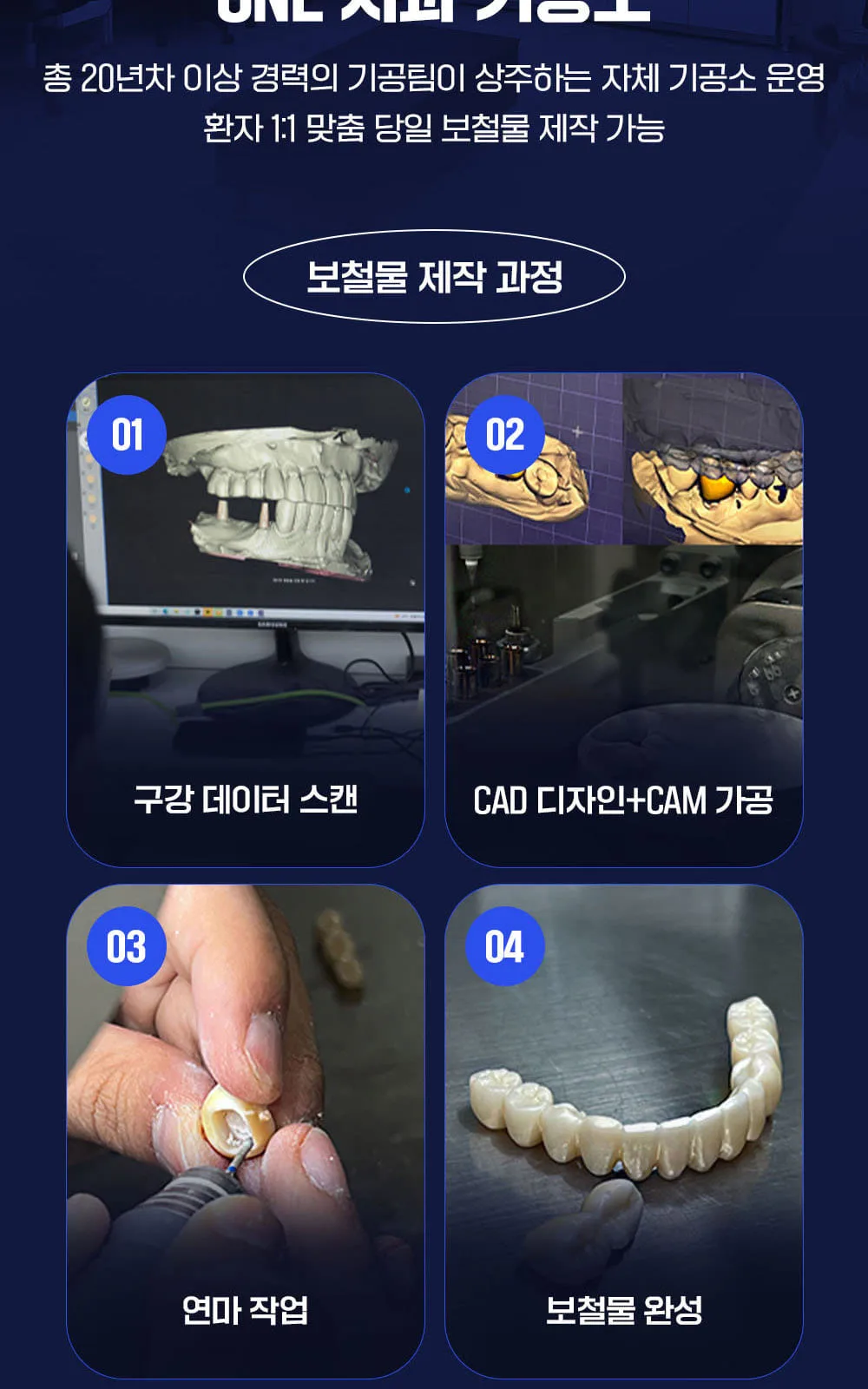 시술 상세 4