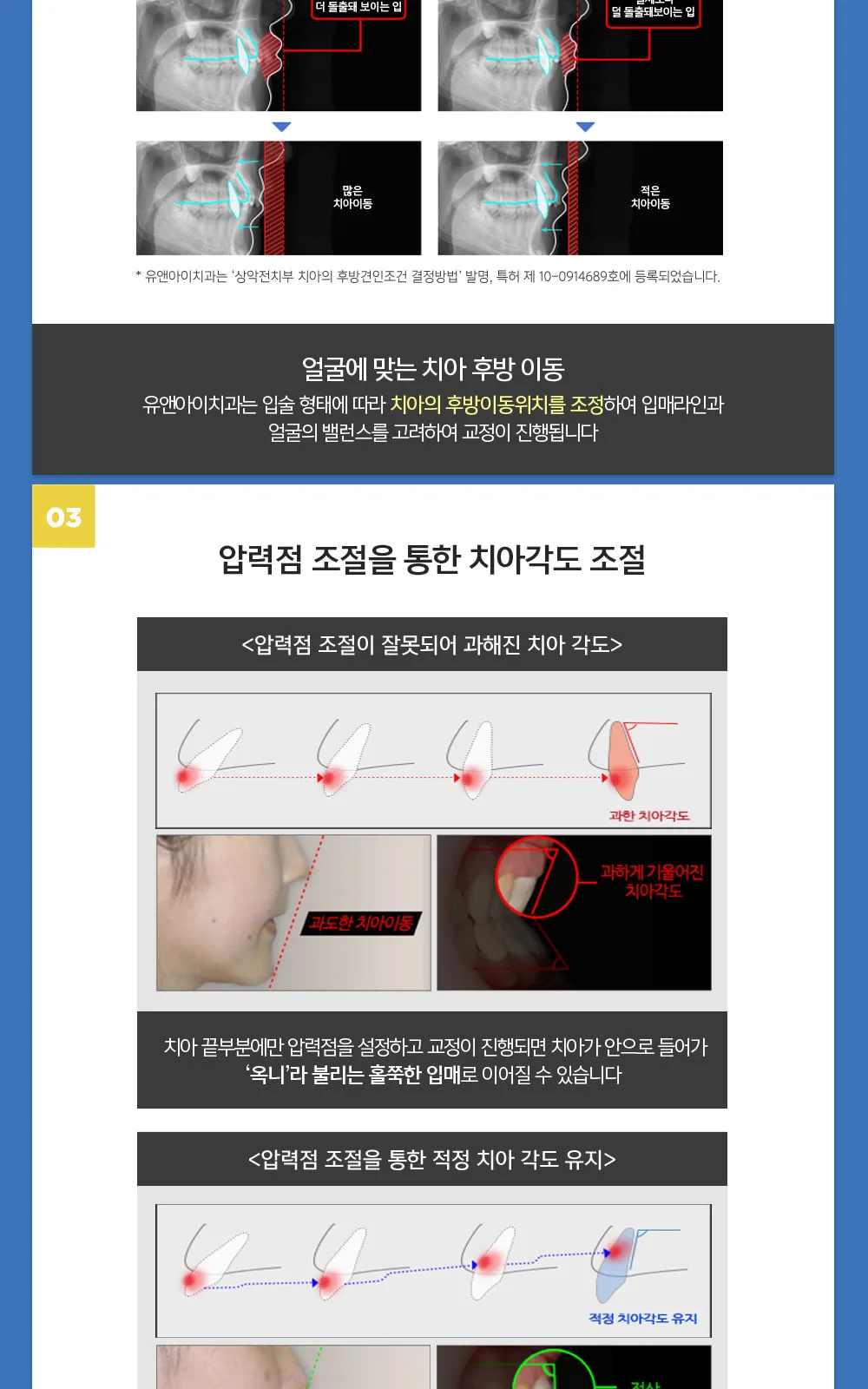 시술 상세 4