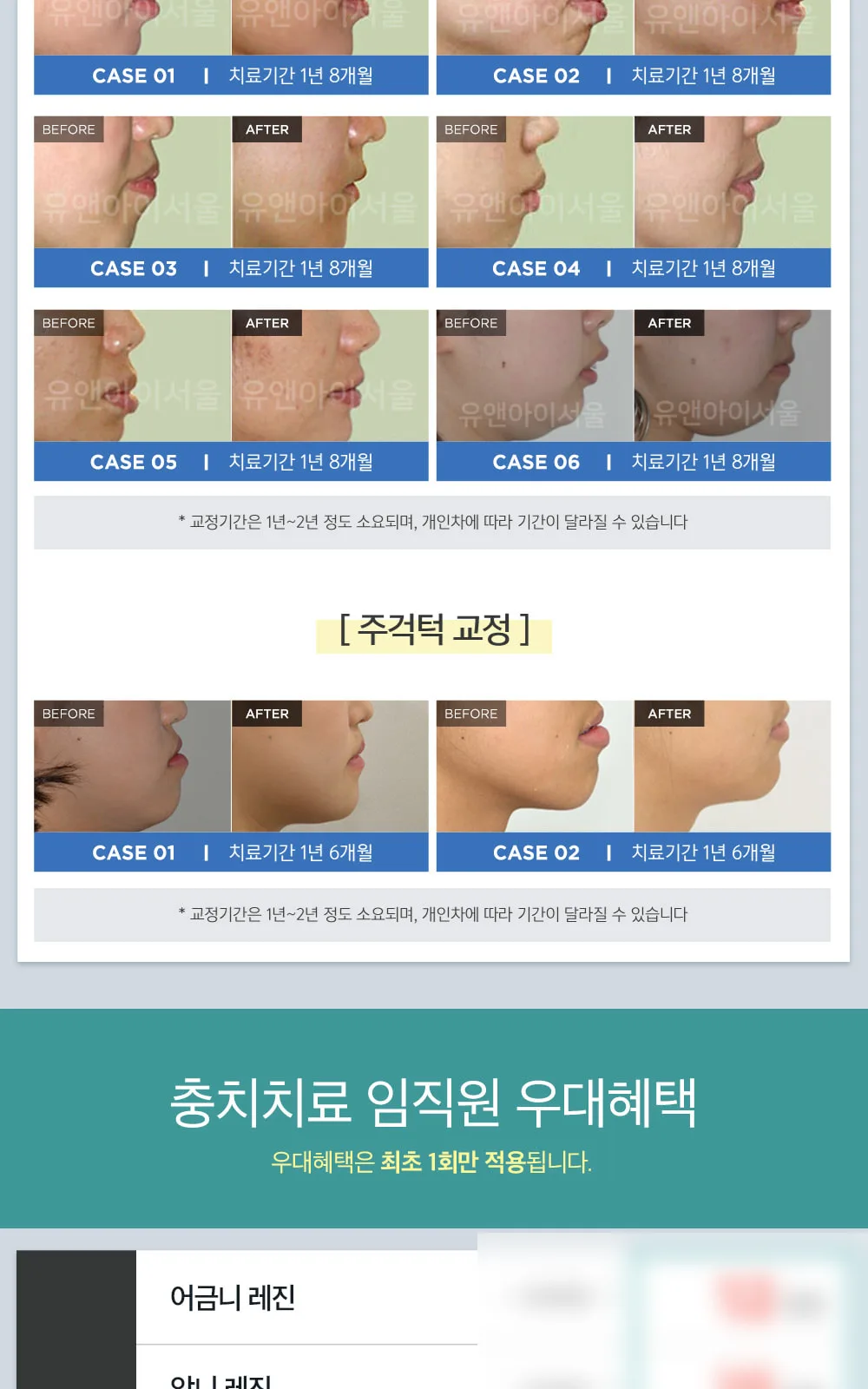 시술 상세 6