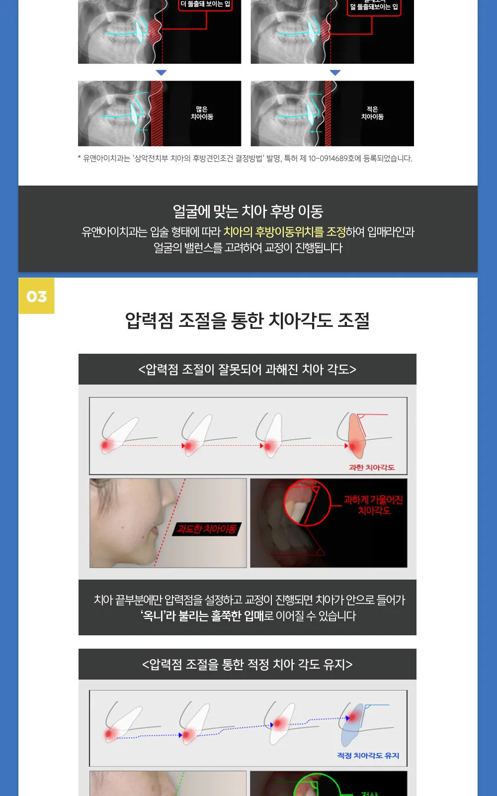 시술 상세 4