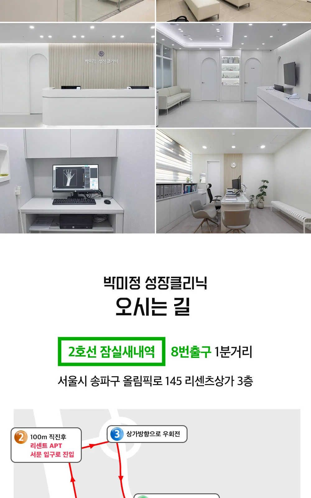 시술 상세 11