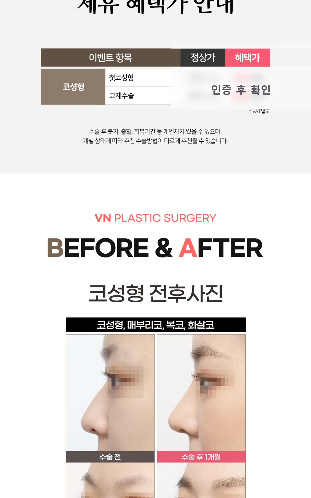 시술 상세 2
