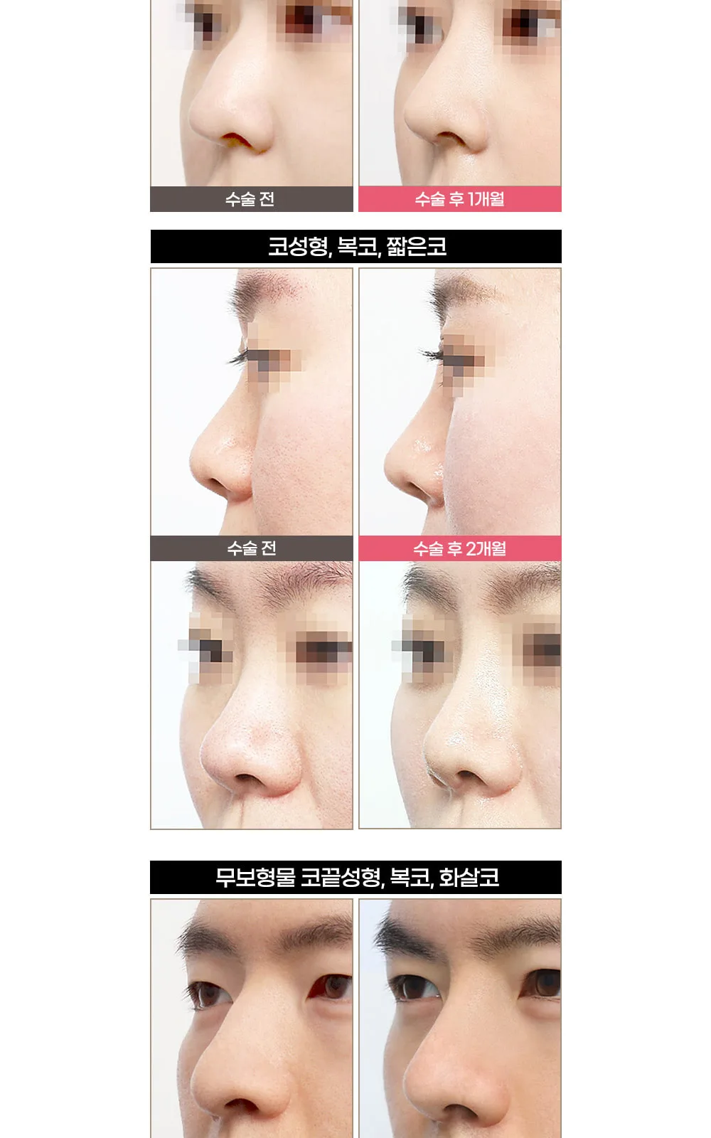 시술 상세 3